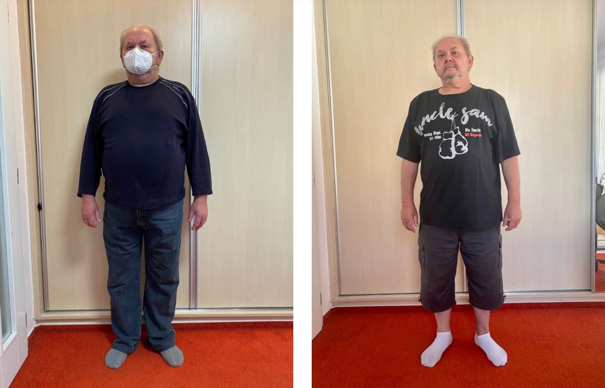 Pan František 65 let, zhubl 17 kg za 6 měsíců