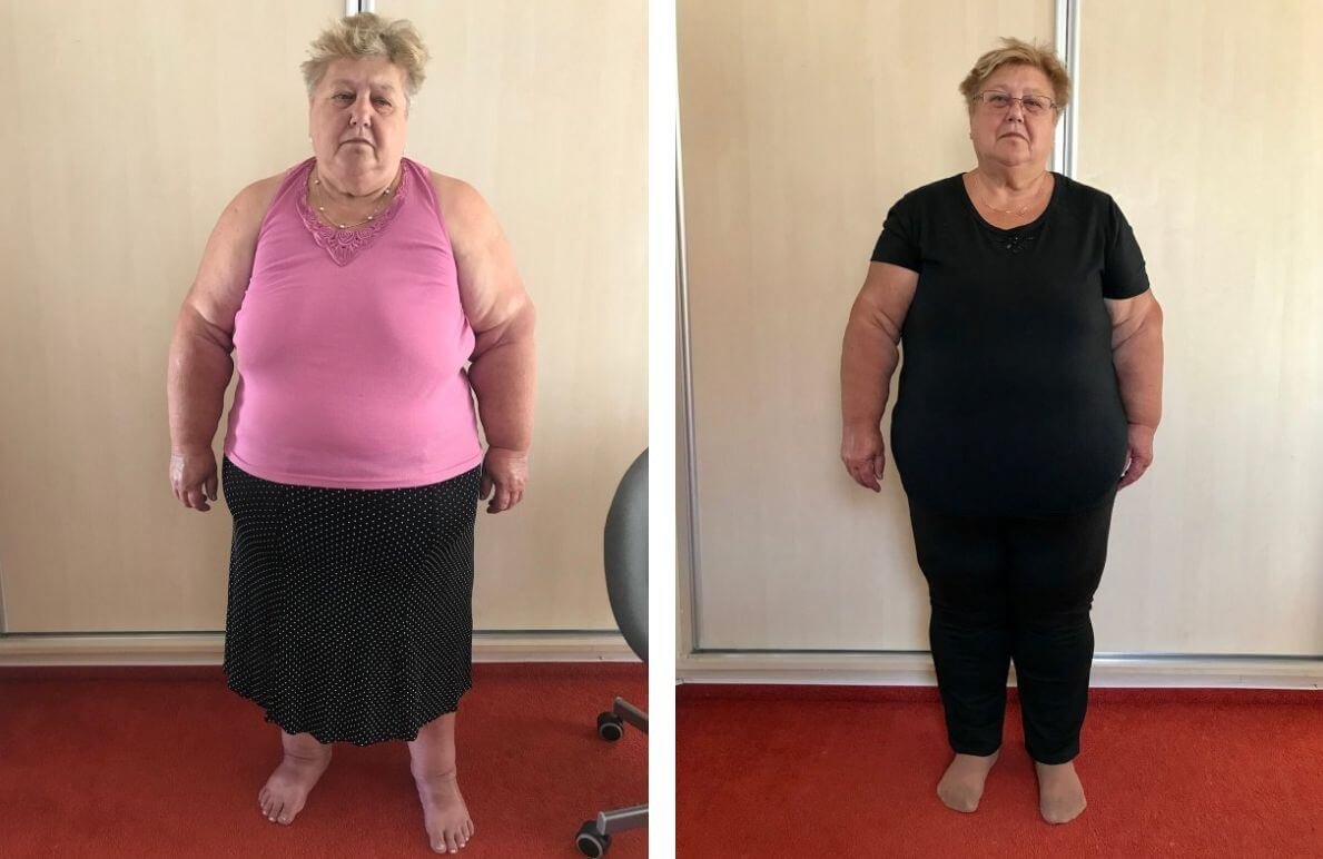 Květoslava 65 let, zhubla 19 kg